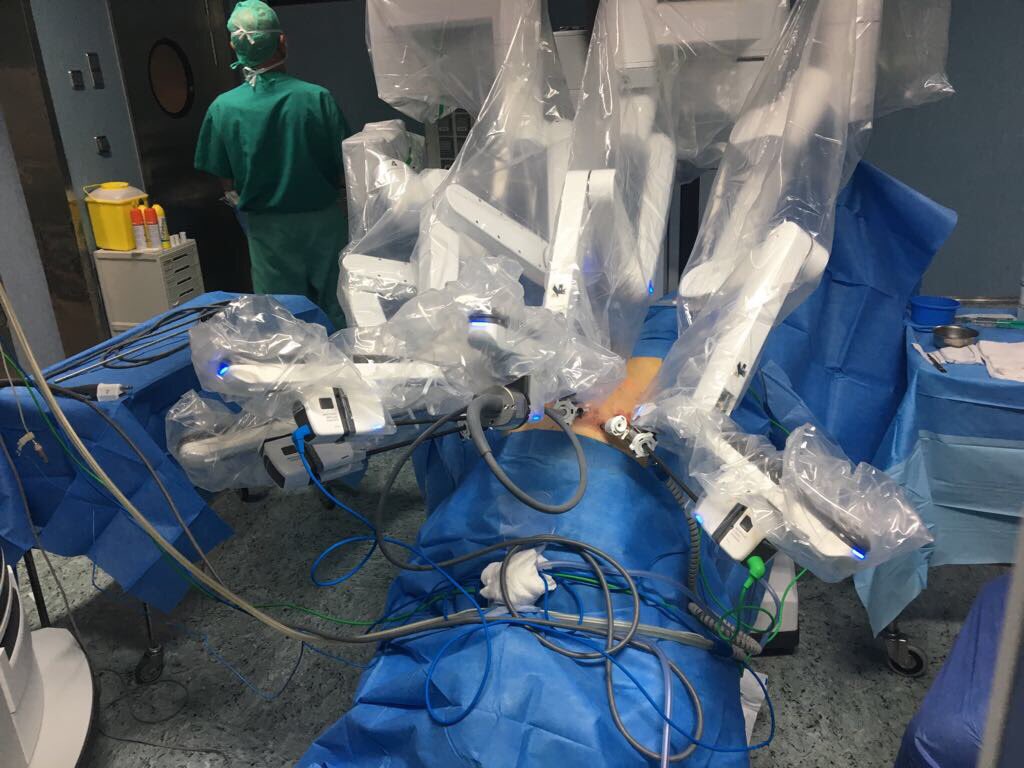 Robot Da Vinci X: primera prostatectomía radical | Cirugía Robótica San Rafael